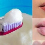 Does Toothpaste help Cold Sores