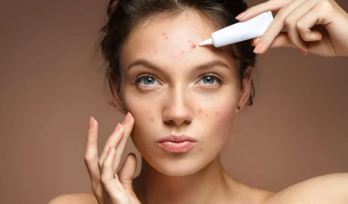 rid of acne spots